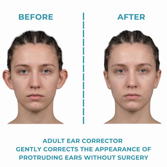 Adult Ear Corrector