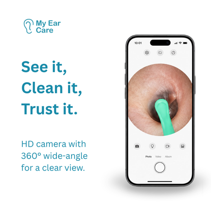 Smart Ear Cleaner