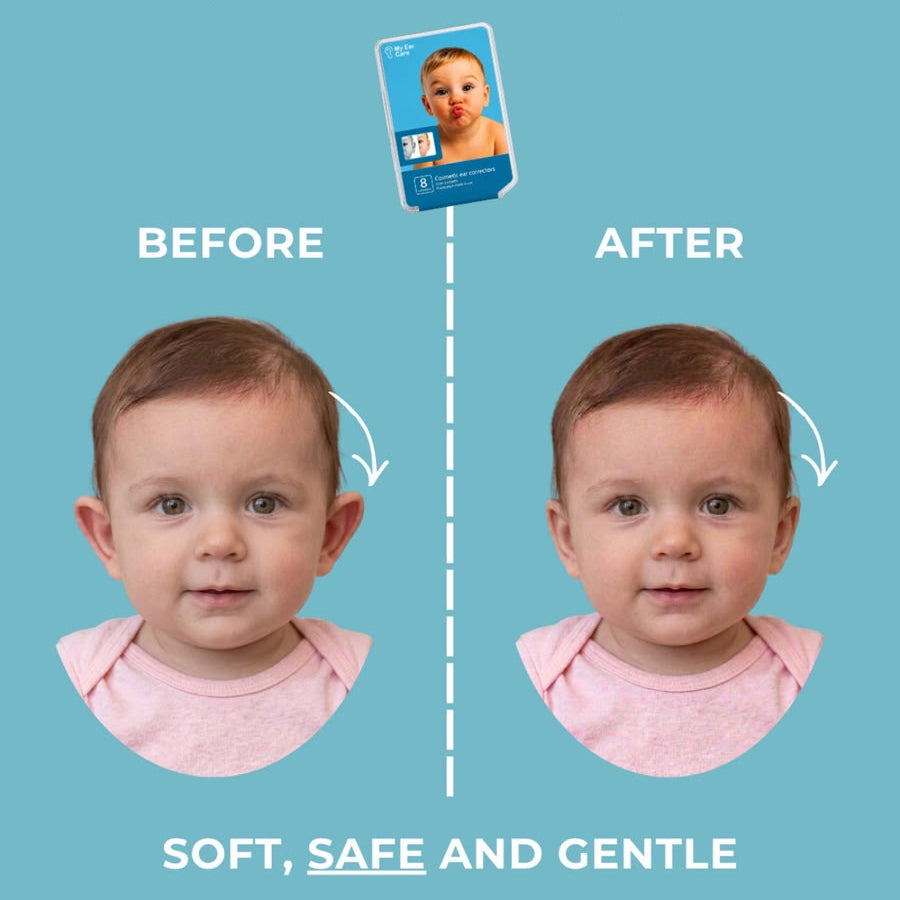 Baby Ear Corrector